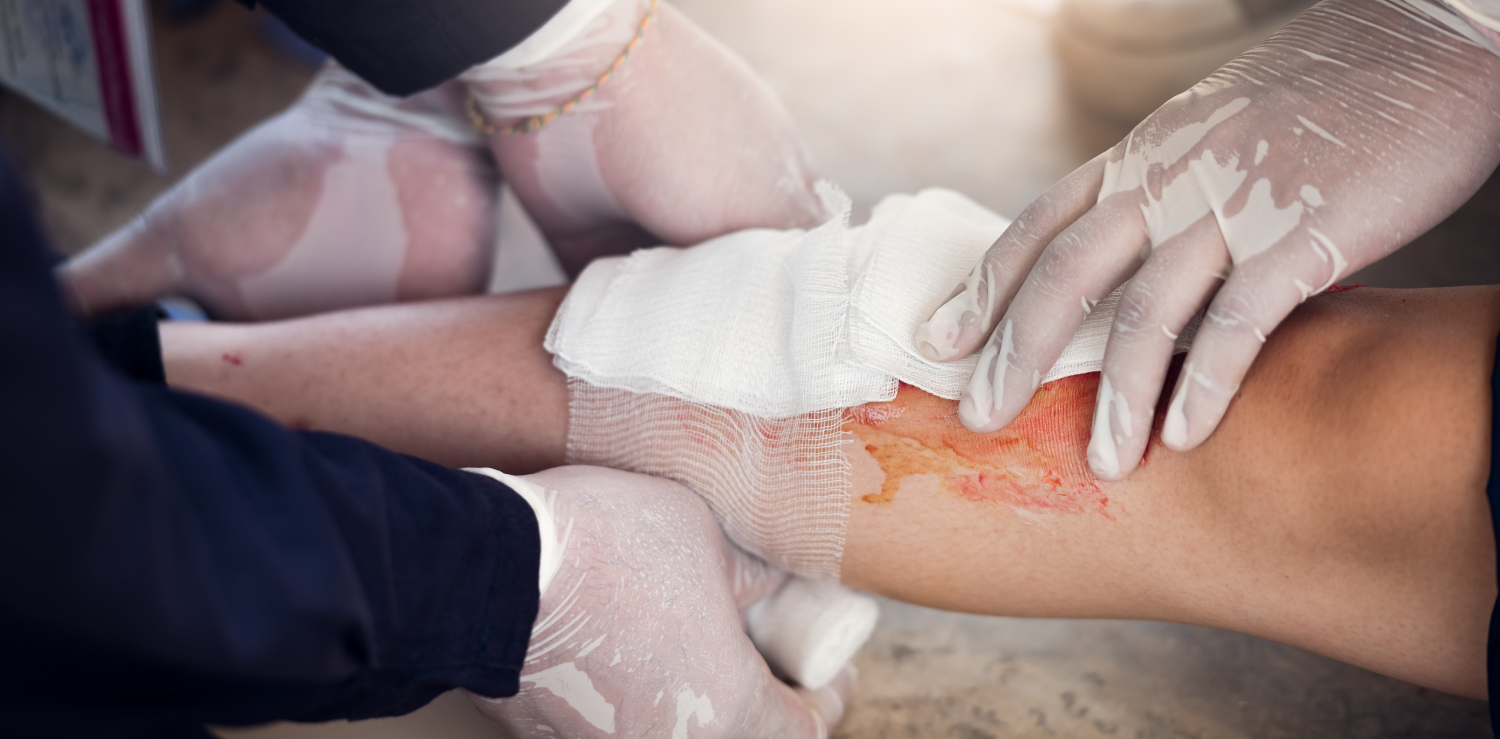 Heartsaver Bloodborne Pathogens Professionals bandaging up a fresh wound and practicing safety around blood exposure.